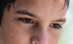 Bài thuốc chữa mồ hôi ra quá nhiều