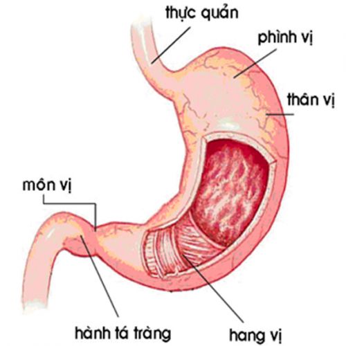 Nguyên nhân, triệu chứng của bệnh đau dạ dày
