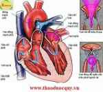 Triệu chứng bệnh tim mạch