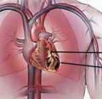 Bệnh tim-những điều cần tránh