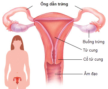 Ung thư buồng trứng
